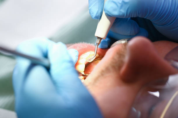 Best Broken Tooth Emergency  in Milton, LA