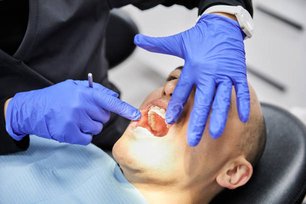 Best Tooth Infection Emergency Dentist  in Milton, LA